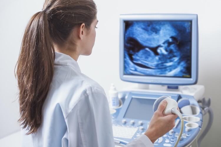 what does a sonographer do